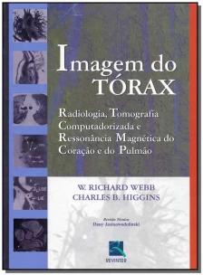 Imagem do Tórax
